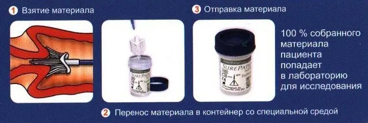наконечник щеточки в специальном растворе