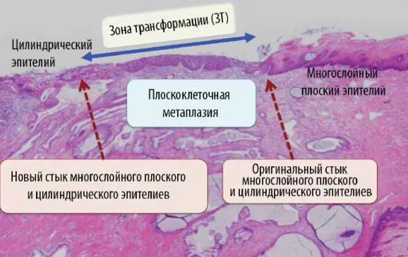строение шейки матки