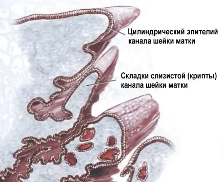 крипты шейки матки